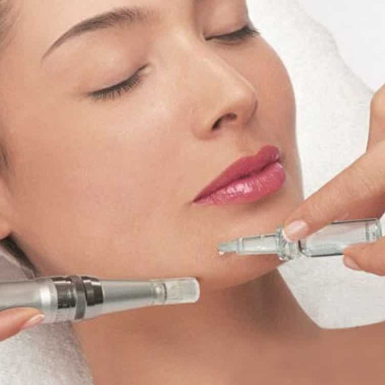 dermapen-bienestetic